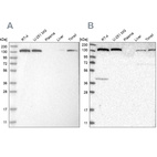 Western blot analysis using Anti-PFAS antibody HPA022140 (A) shows similar pattern to independent antibody HPA022886 (B).