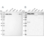 Western blot analysis using Anti-PFAS antibody HPA022140 (A) shows similar pattern to independent antibody HPA022886 (B).