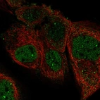 Immunofluorescent staining of human cell line A-431 shows localization to nucleoplasm.