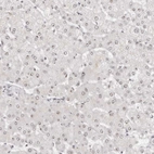 Immunohistochemical staining of human liver shows moderate positivity in nucleoli in hepatocytes.