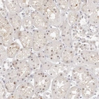 Immunohistochemical staining of human kidney shows moderate positivity in nucleoli in cells in tubules with weak cytoplasmic positivity.