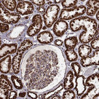 Immunohistochemical staining of human kidney shows strong granular cytoplasmic positivity in cells in tubules and moderate staining in glomerular cells.