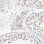 Immunohistochemical staining of human testis shows strong positivity in nucleoli in Leydig cells and cells in seminiferous ducts with weak cytoplasmic positivity.