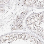 Immunohistochemical staining of human testis shows strong positivity in nucleoli in Leydig cells and cells in seminiferous ducts with weak cytoplasmic positivity.