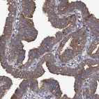 Immunohistochemical staining of human fallopian tube shows strong cytoplasmic positivity in glandular cells.