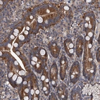 Immunohistochemical staining of human duodenum shows strong cytoplasmic positivity in glandular cells.