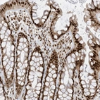 Immunohistochemical staining of human rectum shows strong nuclear positivity in glandular cells.