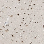 Immunohistochemical staining of human cerebral cortex shows strong nuclear positivity in neurons.