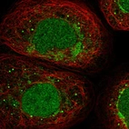 Immunofluorescent staining of human cell line A-431 shows localization to nucleoplasm, mitochondria & vesicles.