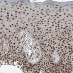 Immunohistochemical staining of human skin shows strong nuclear-cytoplasmic positivity in squamous epithelial cells.