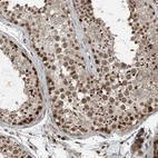 Immunohistochemical staining of human testis shows strong nuclear cytoplasmic positivity in cells in seminiferous ducts.