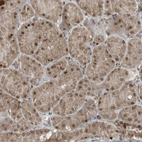Immunohistochemical staining of human kidney shows moderate nuclear cytoplasmic positivity in cells in tubules.