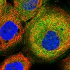 Immunofluorescent staining of human cell line A-431 shows localization to plasma membrane & cytosol.
