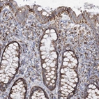 Immunohistochemical staining of human rectum shows strong cytoplasmic granular positivity in glandular cells.