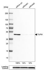 Western blot analysis in U-251MG cells transfected with control siRNA, target specific siRNA probe #1 and #2, using Anti-TUFM antibody. Remaining relative intensity is presented. Loading control: Anti-PPIB.
