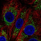 Immunofluorescent staining of human cell line MCF7 shows localization to mitochondria.
