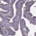 Immunohistochemical staining of human fallopian tube shows moderate positivity in cilia.