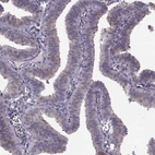Immunohistochemical staining of human fallopian tube shows moderate positivity in cilia.