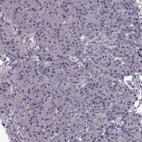 Immunohistochemical staining of human pancreas shows no positivity in exocrine glandular cells as expected.