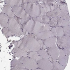 Immunohistochemical staining of human skeletal muscle shows no positivity in myocytes as expected.