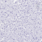 Anti-CD7 Antibody