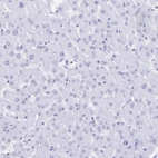 Immunohistochemical staining of human liver shows no positivity in hepatocytes as expected.