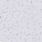 Anti-CD7 Antibody