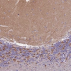 Immunohistochemical staining of human cerebellum shows moderate cytoplasmic positivity in neuropil.