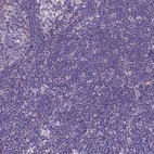Immunohistochemical staining of human lymph node shows no positivity in non-germinal center cells as expected.