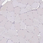 Immunohistochemical staining of human skeletal muscle shows no positivity in myocytes as expected.