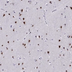 Immunohistochemical staining of human cerebral cortex shows strong nuclear positivity in neurons.
