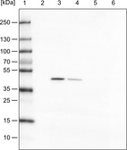 Lane 1: Marker [kDa]_br/_Lane 2: Human cell line HeLa cytoplasmic fraction_br/_Lane 3: Human cell line HeLa membrane fraction_br/_Lane 4: Human cell line HeLa nuclear fraction_br/_Lane 5: Human cell line HeLa chromatin fraction_br/_Lane 6: Human cell line HeLa cytoskeletal fraction