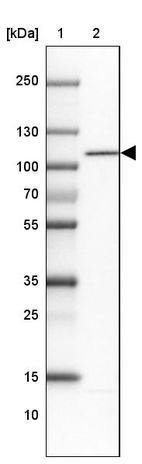 Lane 1: Marker [kDa] 250, 130, 100, 70, 55, 35, 25, 15, 10_br/_Lane 2: Human cell line NTERA-2