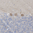 Immunohistochemical staining of human cerebellum shows moderate cytoplasmic positivity in Purkinje cells.