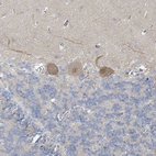 Immunohistochemical staining of human cerebellum shows moderate cytoplasmic positivity in Purkinje cells.