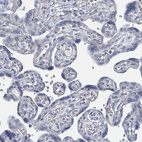 Immunohistochemical staining of human placenta shows no positivity in trophoblastic cells as expected.