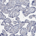 Anti-SLC25A45 Antibody