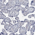 Immunohistochemical staining of human placenta shows no positivity in trophoblastic cells as expected.