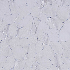 Immunohistochemical staining of human skeletal muscle shows no positivity in myocytes as expected.