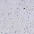 Immunohistochemical staining of human skeletal muscle shows no positivity in myocytes as expected.