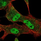 Immunofluorescent staining of human cell line A549 shows localization to nucleoplasm & cytosol.