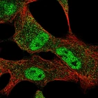 Immunofluorescent staining of human cell line A549 shows localization to nucleoplasm & cytosol.