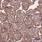 Immunohistochemical staining of human placenta shows strong cytoplasmic and membranous positivity in trophoblastic cells.