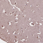 Immunohistochemical staining of human cerebral cortex shows moderate cytoplasmic positivity in neurons.