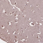 Immunohistochemical staining of human cerebral cortex shows moderate cytoplasmic positivity in neurons.