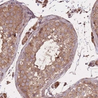 Immunohistochemical staining of human testis shows strong cytoplasmic positivity in cells in seminiferous ducts and leydig cells.