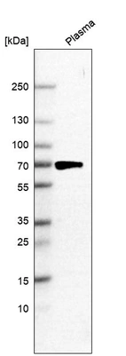 Western blot analysis in human plasma.