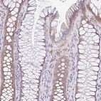 Immunohistochemical staining of human rectum shows moderate cytoplasmic positivity in glandular cells.