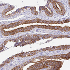 Immunohistochemical staining of human fallopian tube shows strong cytoplasmic and membranous positivity in glandular cells.