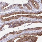 Immunohistochemical staining of human fallopian tube shows strong cytoplasmic and membranous positivity in glandular cells.